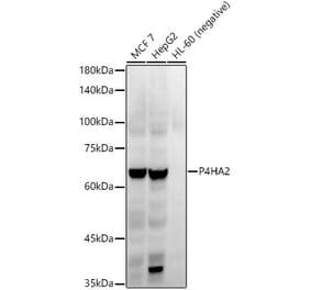 Western Blot - Anti-P4HA2 Antibody [ARC54912] (A306134) - Antibodies.com