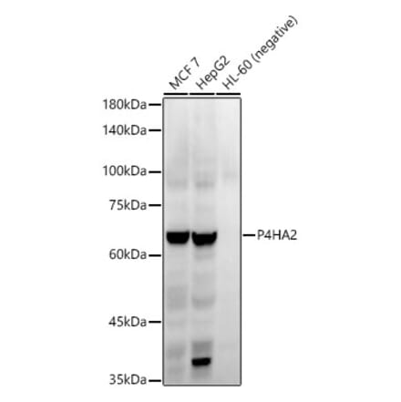 Western Blot - Anti-P4HA2 Antibody [ARC54912] (A306134) - Antibodies.com