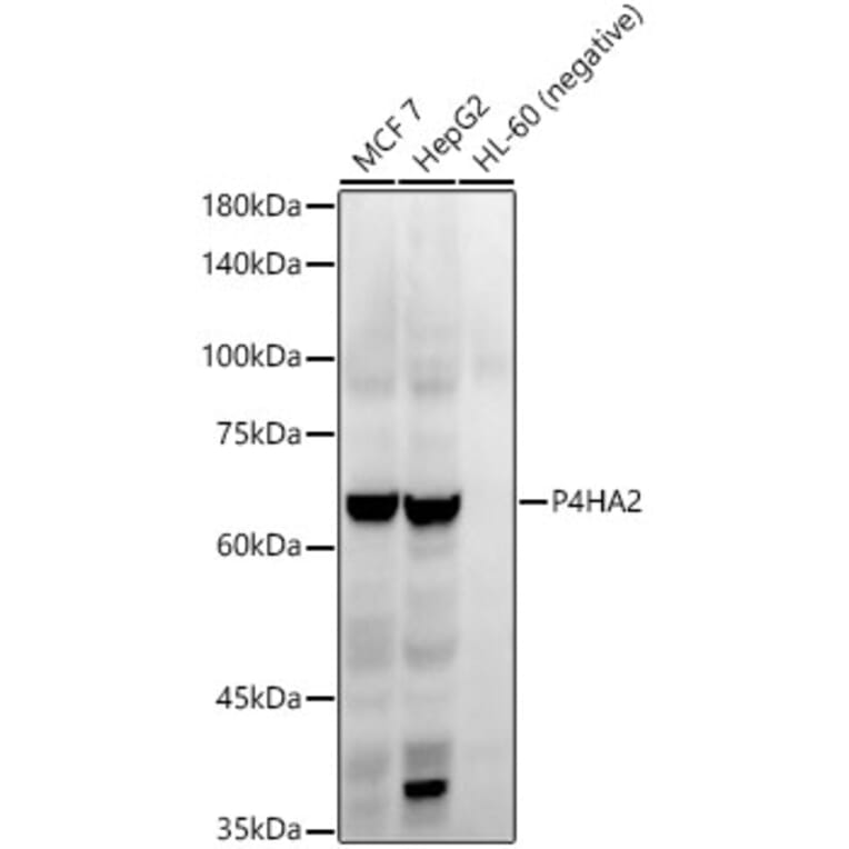 Western Blot - Anti-P4HA2 Antibody [ARC54912] (A306134) - Antibodies.com