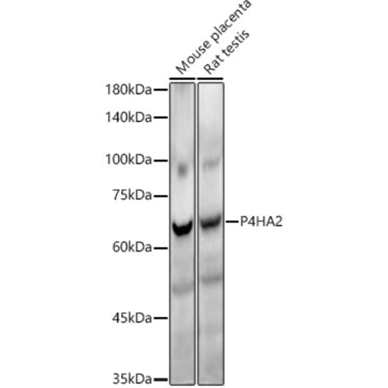 Western Blot - Anti-P4HA2 Antibody [ARC54912] (A306134) - Antibodies.com