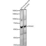 Western Blot - Anti-P4HA2 Antibody [ARC54912] (A306134) - Antibodies.com