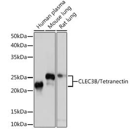 Western Blot - Anti-Tetranectin Antibody [ARC0993] (A306136) - Antibodies.com