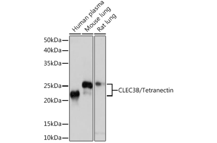 Western Blot - Anti-Tetranectin Antibody [ARC0993] (A306136) - Antibodies.com