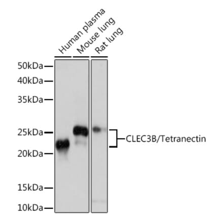 Western Blot - Anti-Tetranectin Antibody [ARC0993] (A306136) - Antibodies.com