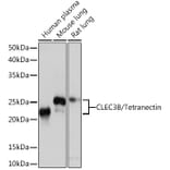 Western Blot - Anti-Tetranectin Antibody [ARC0993] (A306136) - Antibodies.com