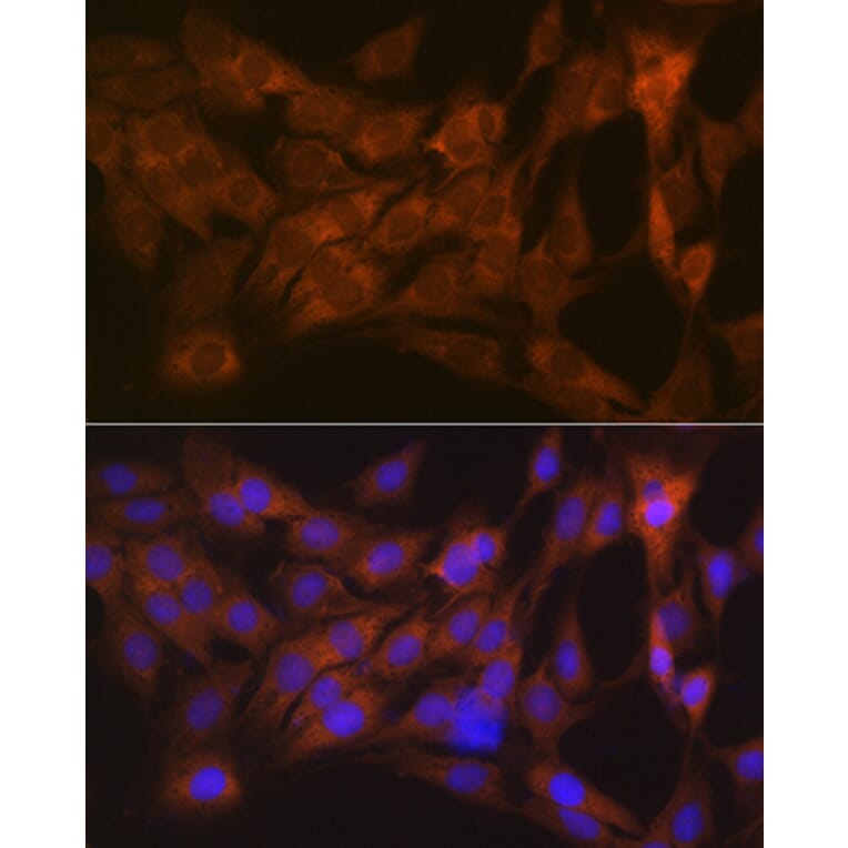 Immunofluorescence - Anti-Tetranectin Antibody [ARC0993] (A306136) - Antibodies.com