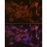 Immunofluorescence - Anti-Tetranectin Antibody [ARC0993] (A306136) - Antibodies.com