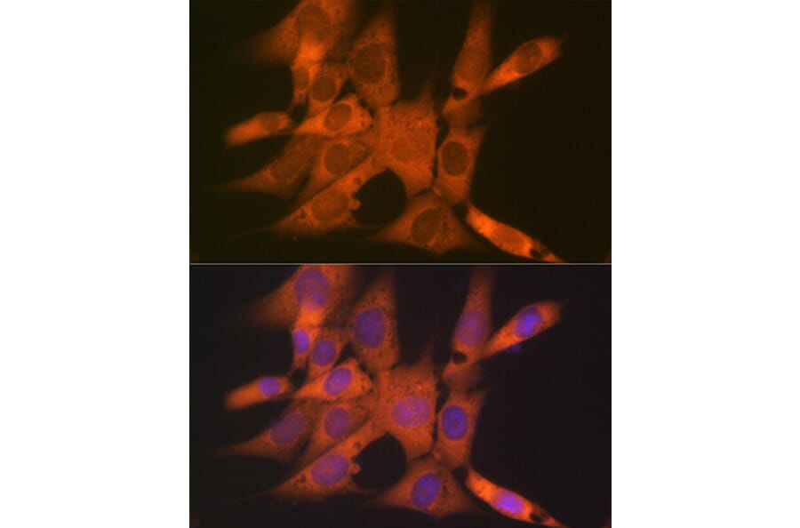 Immunofluorescence - Anti-Tetranectin Antibody [ARC0993] (A306136) - Antibodies.com