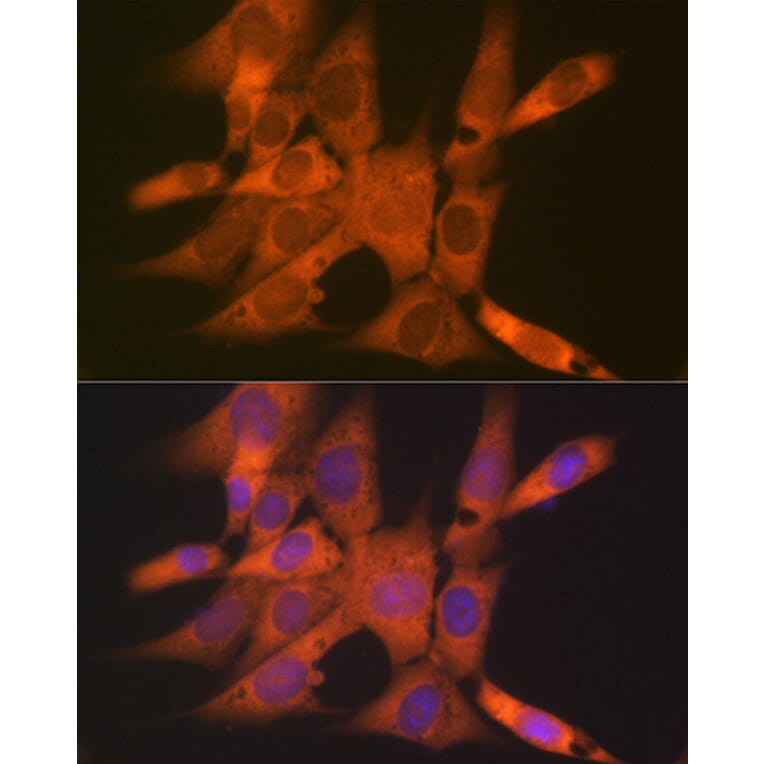 Immunofluorescence - Anti-Tetranectin Antibody [ARC0993] (A306136) - Antibodies.com