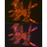 Immunofluorescence - Anti-Tetranectin Antibody [ARC0993] (A306136) - Antibodies.com