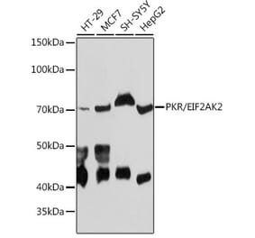 Western Blot - Anti-PKR Antibody [ARC0024] (A306137) - Antibodies.com