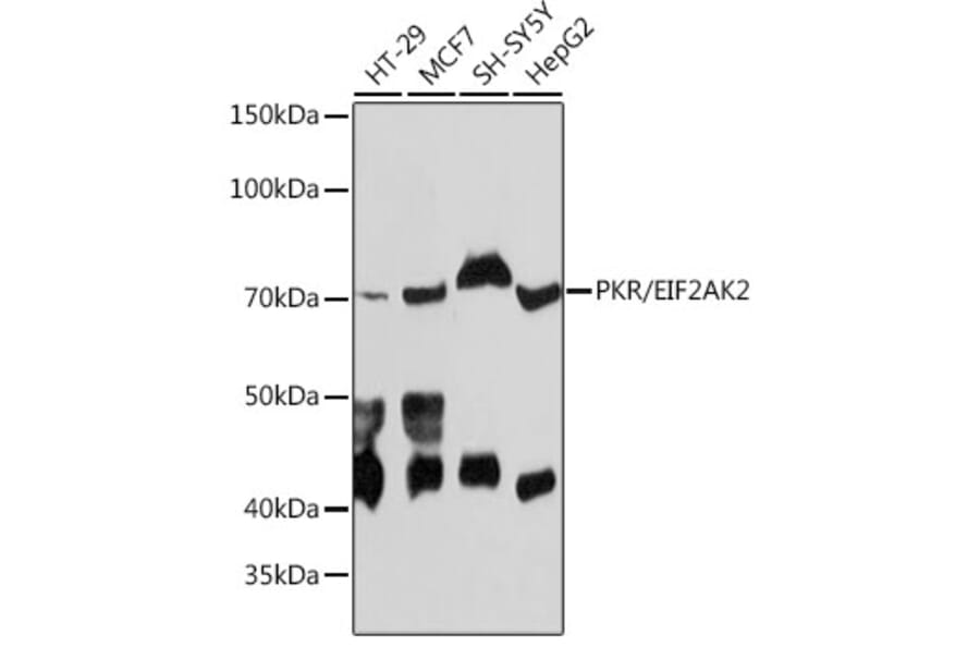 Western Blot - Anti-PKR Antibody [ARC0024] (A306137) - Antibodies.com