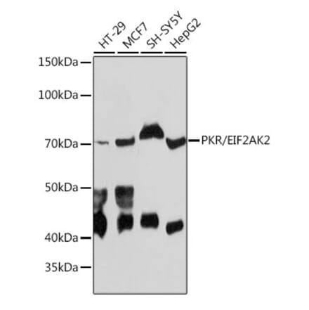 Western Blot - Anti-PKR Antibody [ARC0024] (A306137) - Antibodies.com
