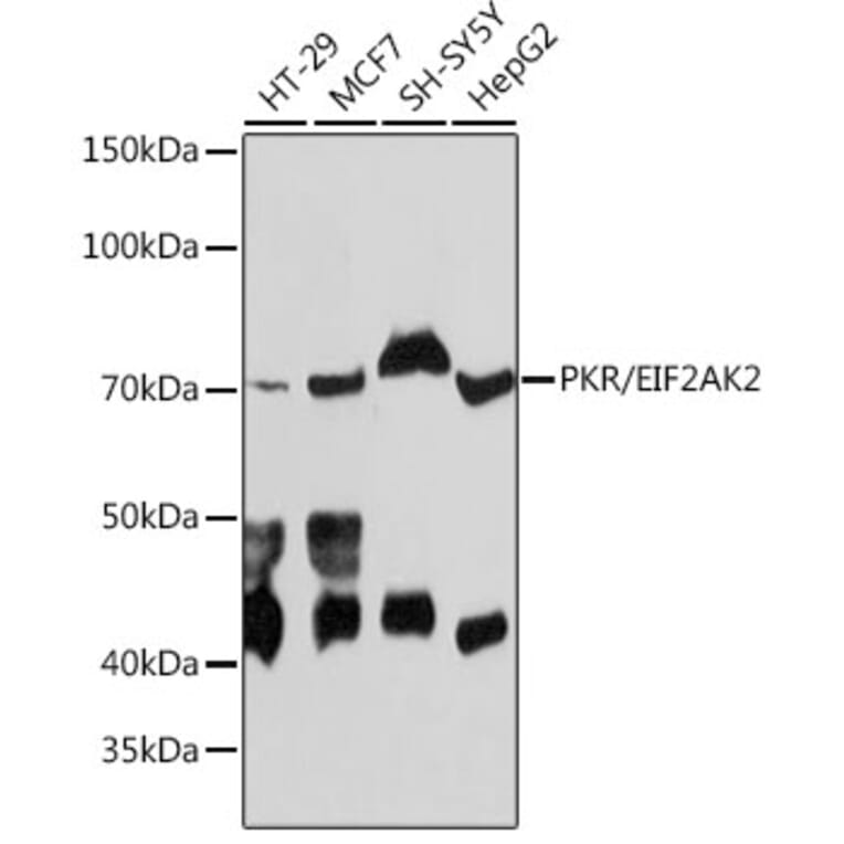 Western Blot - Anti-PKR Antibody [ARC0024] (A306137) - Antibodies.com
