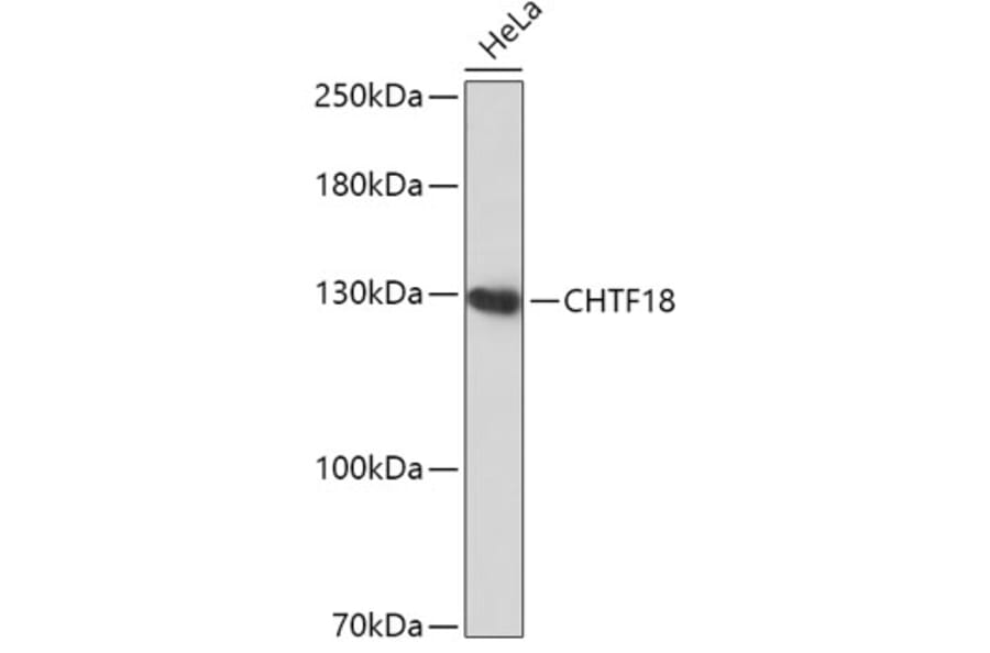 Western Blot - Anti-CTF18 Antibody (A306138) - Antibodies.com
