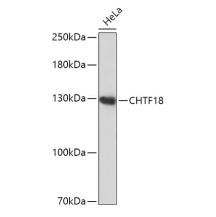 Western Blot - Anti-CTF18 Antibody (A306138) - Antibodies.com