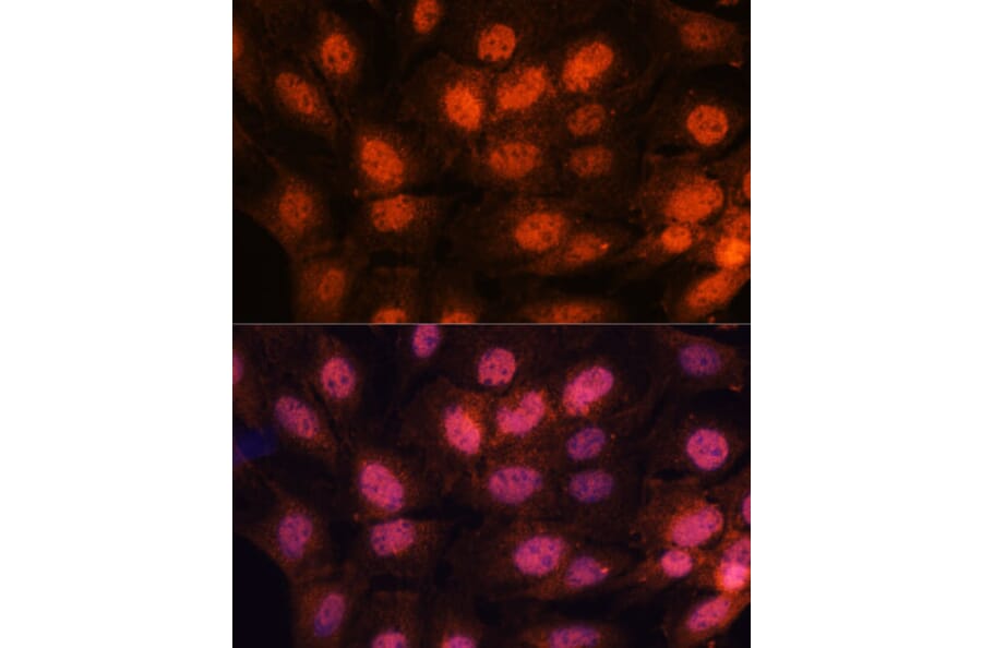 Immunofluorescence - Anti-CTF18 Antibody (A306138) - Antibodies.com