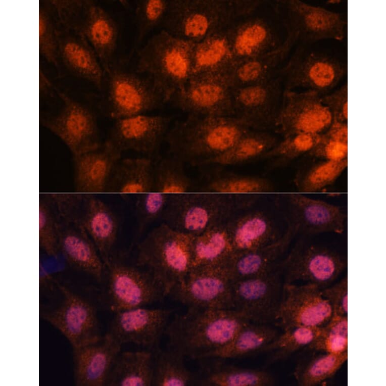 Immunofluorescence - Anti-CTF18 Antibody (A306138) - Antibodies.com