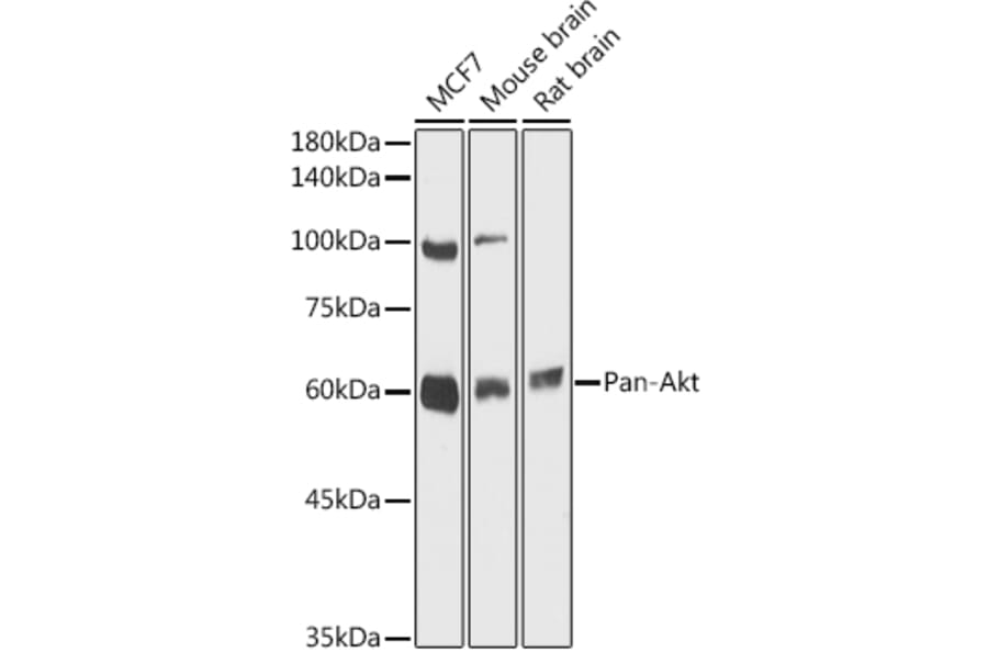 Western Blot - Anti-AKT1 + AKT2 + AKT3 Antibody (A306139) - Antibodies.com