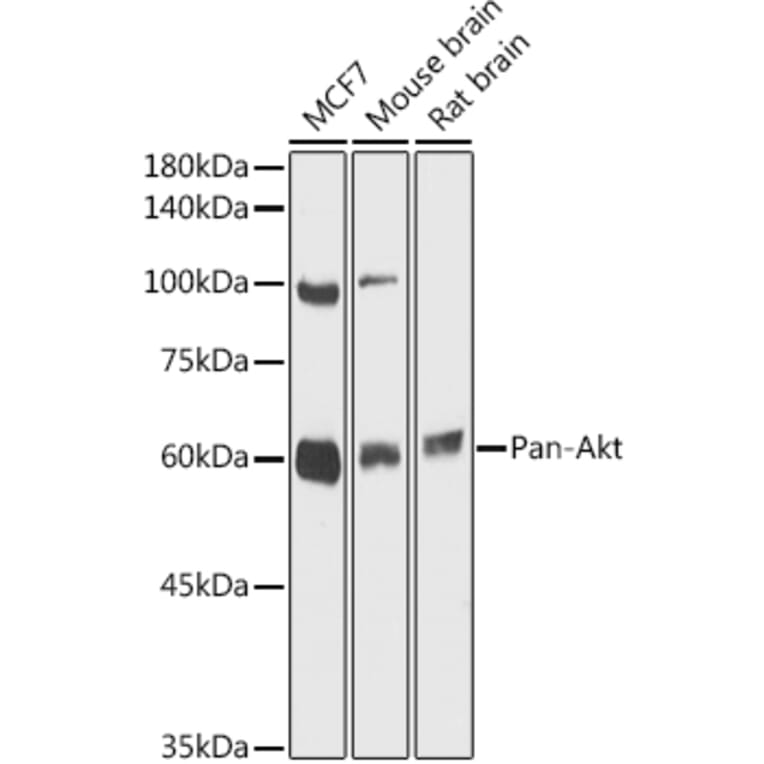Western Blot - Anti-AKT1 + AKT2 + AKT3 Antibody (A306139) - Antibodies.com