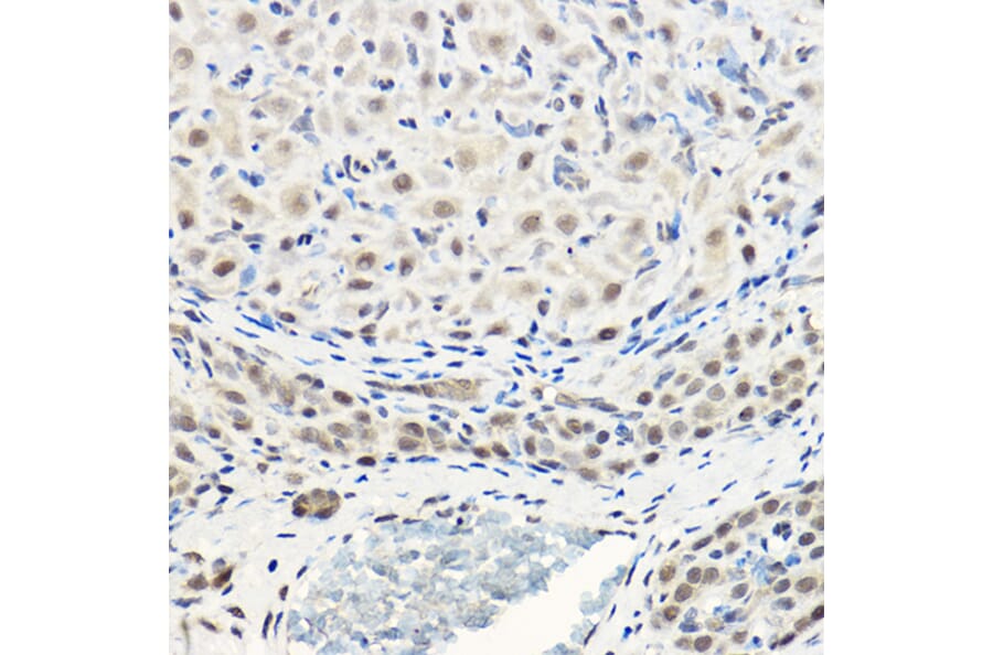 Immunohistochemistry - Anti-AKT1 + AKT2 + AKT3 Antibody (A306139) - Antibodies.com