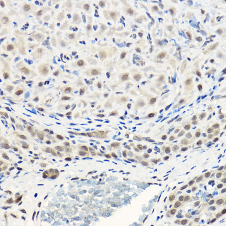 Immunohistochemistry - Anti-AKT1 + AKT2 + AKT3 Antibody (A306139) - Antibodies.com