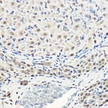 Immunohistochemistry - Anti-AKT1 + AKT2 + AKT3 Antibody (A306139) - Antibodies.com