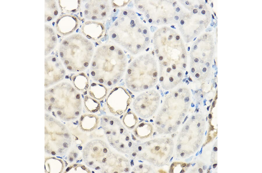 Immunohistochemistry - Anti-AKT1 + AKT2 + AKT3 Antibody (A306139) - Antibodies.com