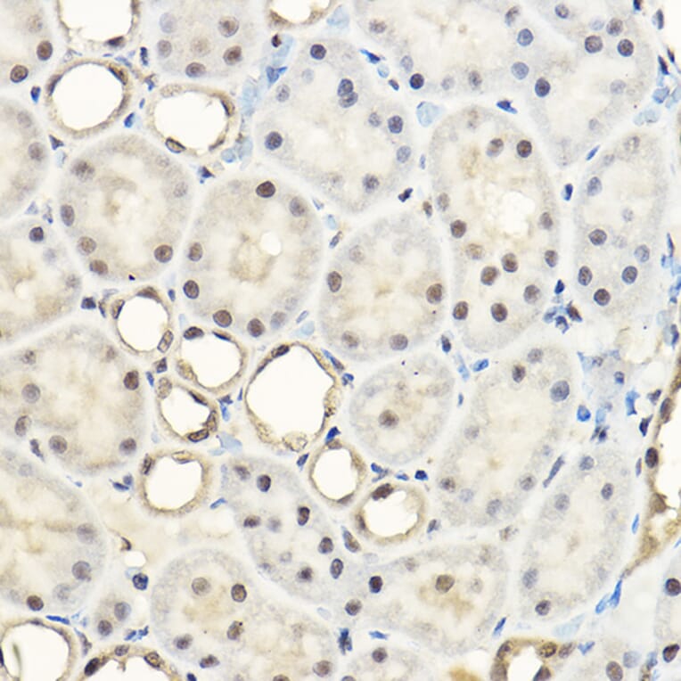 Immunohistochemistry - Anti-AKT1 + AKT2 + AKT3 Antibody (A306139) - Antibodies.com
