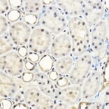 Immunohistochemistry - Anti-AKT1 + AKT2 + AKT3 Antibody (A306139) - Antibodies.com