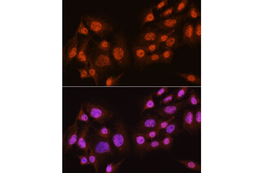 Immunofluorescence - Anti-AKT1 + AKT2 + AKT3 Antibody (A306139) - Antibodies.com