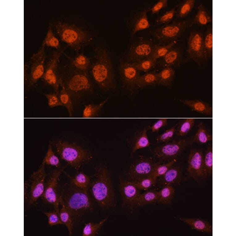 Immunofluorescence - Anti-AKT1 + AKT2 + AKT3 Antibody (A306139) - Antibodies.com