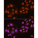Immunofluorescence - Anti-AKT1 + AKT2 + AKT3 Antibody (A306139) - Antibodies.com