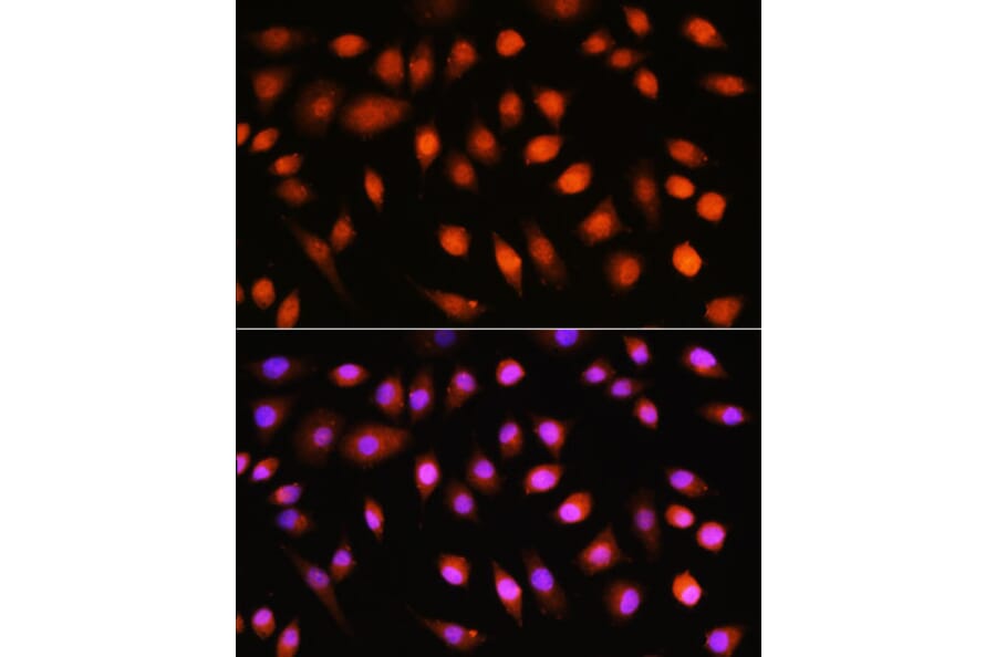 Immunofluorescence - Anti-AKT1 + AKT2 + AKT3 Antibody (A306139) - Antibodies.com