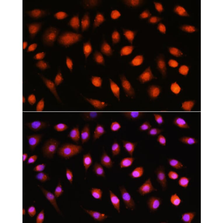 Immunofluorescence - Anti-AKT1 + AKT2 + AKT3 Antibody (A306139) - Antibodies.com
