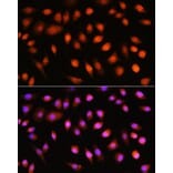Immunofluorescence - Anti-AKT1 + AKT2 + AKT3 Antibody (A306139) - Antibodies.com