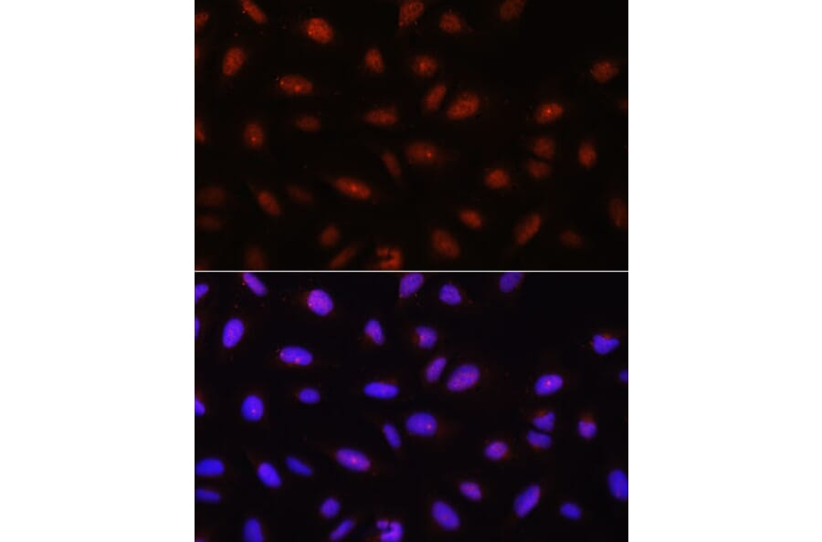 Immunofluorescence - Anti-AKT1 + AKT2 + AKT3 Antibody (A306139) - Antibodies.com