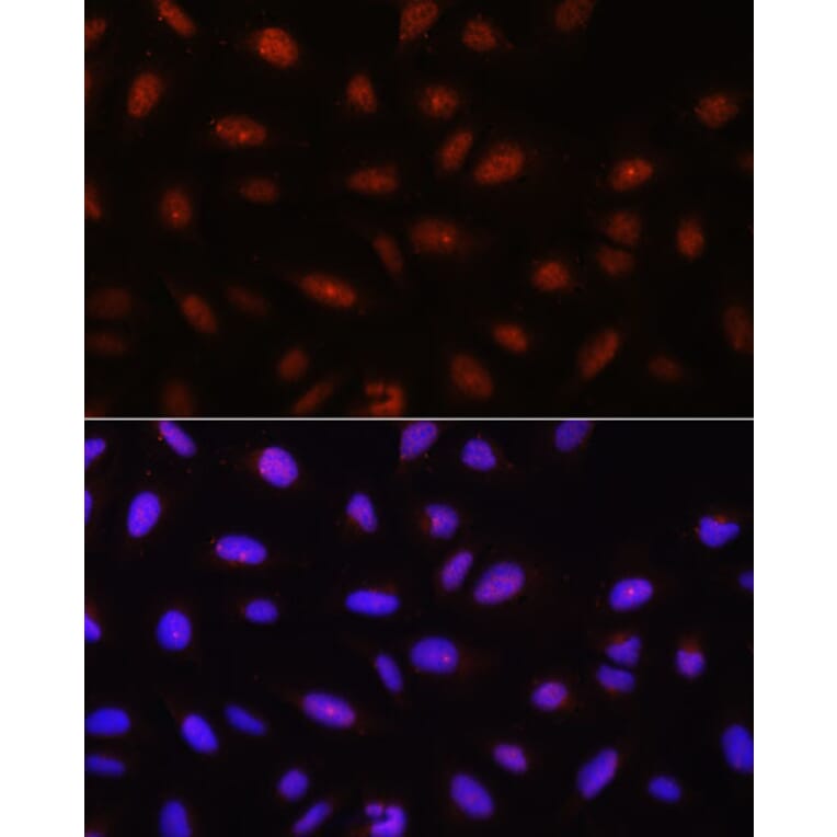 Immunofluorescence - Anti-AKT1 + AKT2 + AKT3 Antibody (A306139) - Antibodies.com