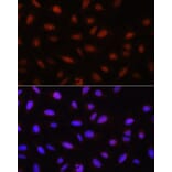 Immunofluorescence - Anti-AKT1 + AKT2 + AKT3 Antibody (A306139) - Antibodies.com