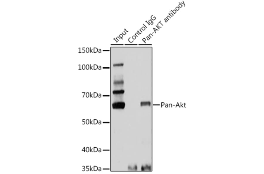 Western Blot - Anti-AKT1 + AKT2 + AKT3 Antibody (A306139) - Antibodies.com