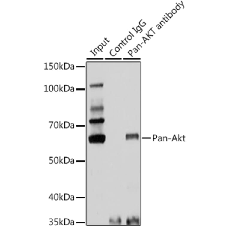 Western Blot - Anti-AKT1 + AKT2 + AKT3 Antibody (A306139) - Antibodies.com