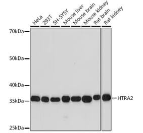 Western Blot - Anti-HtrA2 / Omi Antibody [ARC0864] (A306140) - Antibodies.com