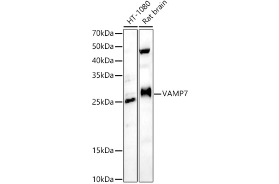 Western Blot - Anti-SYBL1/VAMP-7 Antibody (A306141) - Antibodies.com