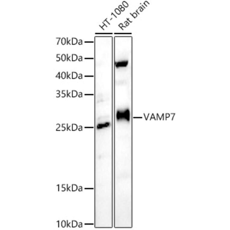 Western Blot - Anti-SYBL1/VAMP-7 Antibody (A306141) - Antibodies.com