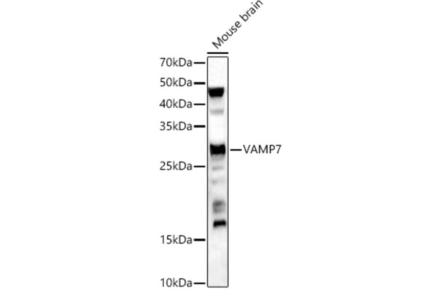 Western Blot - Anti-SYBL1/VAMP-7 Antibody (A306141) - Antibodies.com