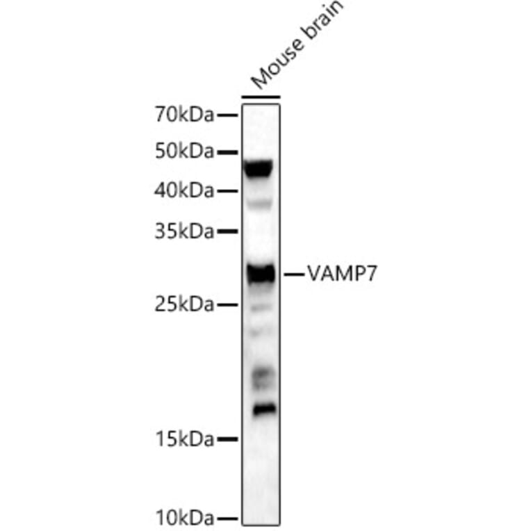 Western Blot - Anti-SYBL1/VAMP-7 Antibody (A306141) - Antibodies.com