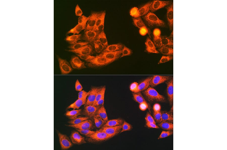 Immunofluorescence - Anti-SYBL1/VAMP-7 Antibody (A306141) - Antibodies.com