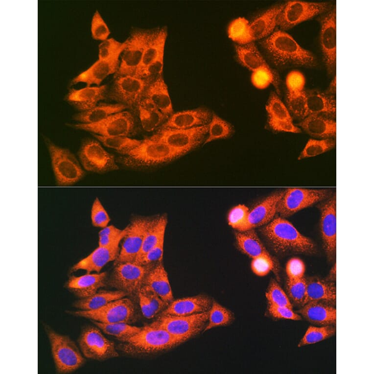 Immunofluorescence - Anti-SYBL1/VAMP-7 Antibody (A306141) - Antibodies.com