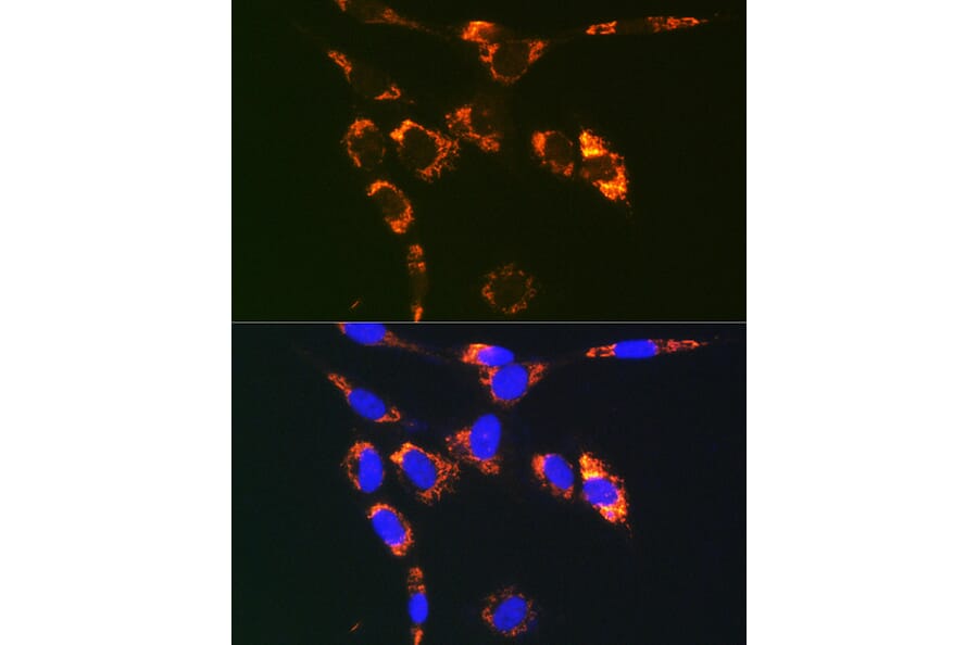 Immunofluorescence - Anti-SYBL1/VAMP-7 Antibody (A306141) - Antibodies.com