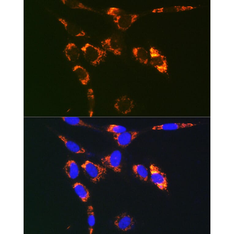 Immunofluorescence - Anti-SYBL1/VAMP-7 Antibody (A306141) - Antibodies.com